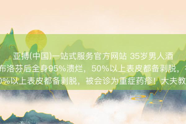 亚搏(中国)一站式服务官方网站 35岁男人酒背面疼发烧，连喝3次布洛芬后全身95%溃烂，50%以上表皮都备剥脱，被会诊为重症药疹！大夫教导